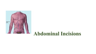 Abdominal Incisions
 