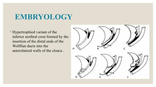 Anterior and Posterior Urethral Valves.pptx