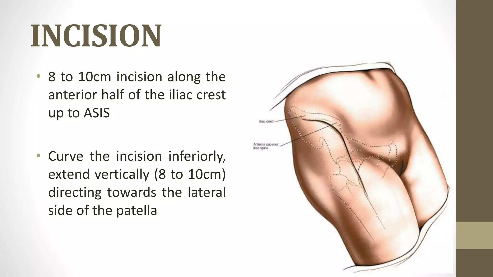 Anterior approach to the hip - Dr. Sachin M | PPTX