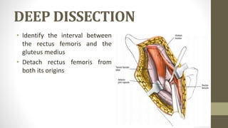 Anterior approach to the hip - Dr. Sachin M | PPTX