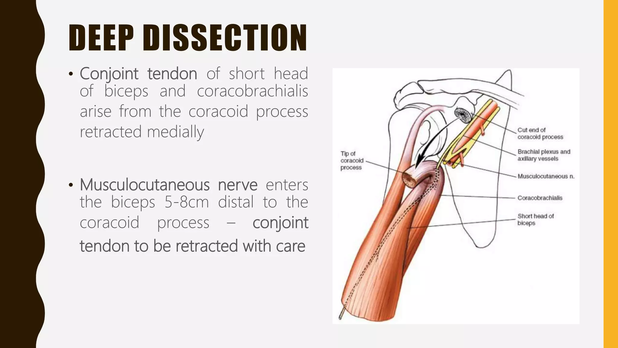 DEEP DISSECTION
• Conjoint tendon of short head
of biceps and coracobrachialis
arise from the coracoid process
retracted medially
• Musculocutaneous nerve enters
the biceps 5-8cm distal to the
coracoid process – conjoint
tendon to be retracted with care
 