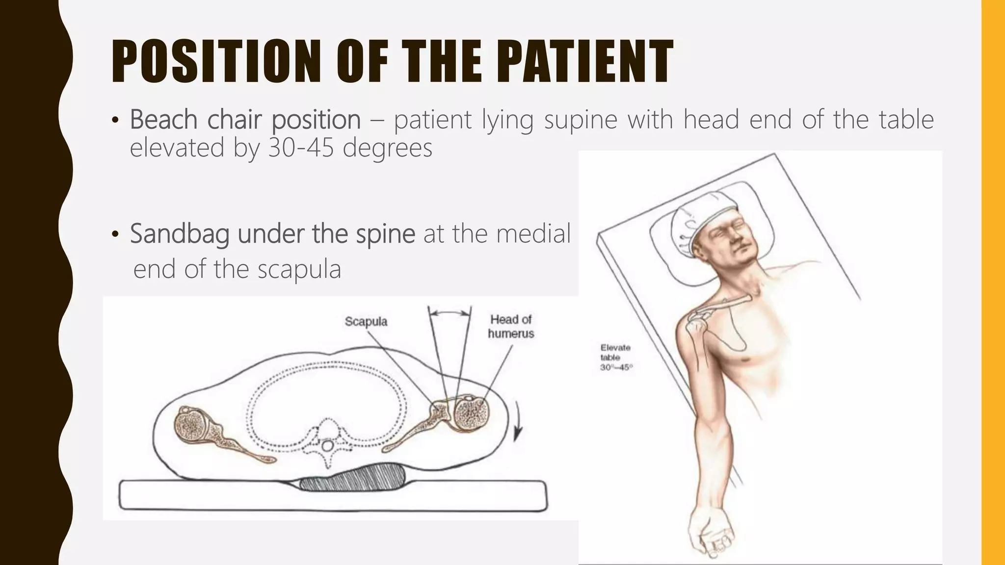 POSITION OF THE PATIENT
• Beach chair position – patient lying supine with head end of the table
elevated by 30-45 degrees
• Sandbag under the spine at the medial
end of the scapula
 