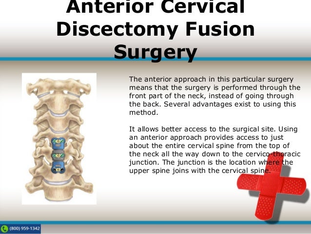 L4 l5 discectomy procedure picture