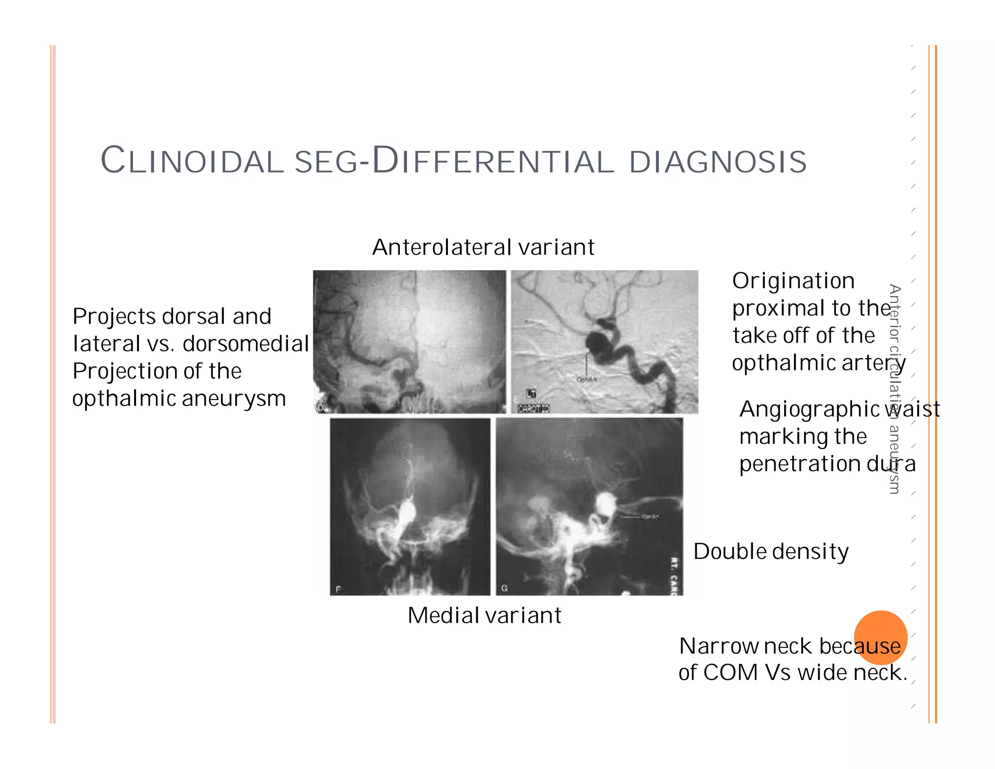 Anterior circulation aneurysms and surgical considerations 2011 | PDF