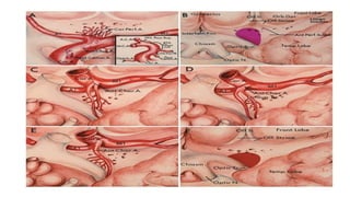 Comprehensive Overview of Anterior Circulation Cerebrovascular Anatomy ...