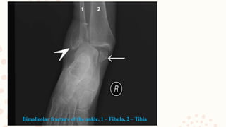 Anterior compartment of the Leg_114.pptx