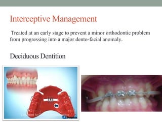 Interceptive Management
Treated at an early stage to prevent a minor orthodontic problem
from progressing into a major dento-facial anomaly.
Deciduous Dentition
 