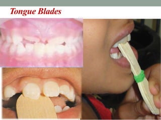Tongue Blades
 