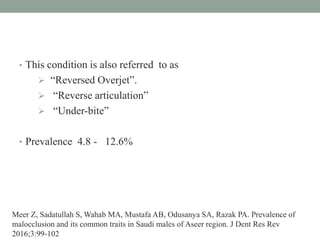 • This condition is also referred to as
 “Reversed Overjet”.
 “Reverse articulation”
 “Under-bite”
• Prevalence 4.8 - 12.6%
Meer Z, Sadatullah S, Wahab MA, Mustafa AB, Odusanya SA, Razak PA. Prevalence of
malocclusion and its common traits in Saudi males of Aseer region. J Dent Res Rev
2016;3:99-102
 