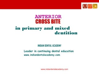 ANTERIOR
CROSS BITE
in primary and mixed
dentition
INDIAN DENTAL ACADEMY
Leader in continuing dental education
www.indiandentalacademy.com

www.indiandentalacademy.com

 