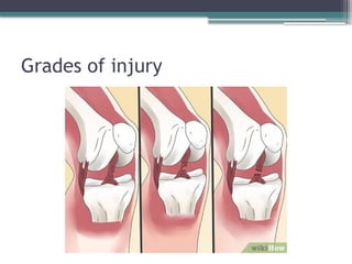 Anterior Cruciate Ligament Injuries.pptx