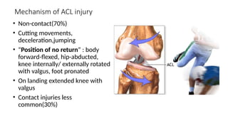 Anterior cruciate ligament injuries.pptx