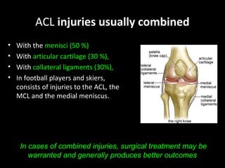 Anterior Cruciate ligament Injury | PPT