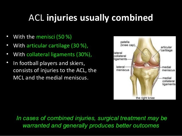 a discussion on the nature of the anterior crucial ligament acl injury Effect of anterior cruciate ligament injury and reconstruction on proprioceptive acuity of knee rotation in the transverse plane am j sports med 200937(8):1618–26 pubmed view article google scholar strehl a, eggli s the value of conservative treatment in ruptures of the anterior cruciate ligament (acl) j trauma 200762(5):1159–62. a discussion on the nature of the anterior crucial ligament acl injury Effect of anterior cruciate ligament injury and reconstruction on proprioceptive acuity of knee rotation in the transverse plane am j sports med 200937(8):1618–26 pubmed view article google scholar strehl a, eggli s the value of conservative treatment in ruptures of the anterior cruciate ligament (acl) j trauma 200762(5):1159–62.