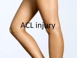 ACL injury 