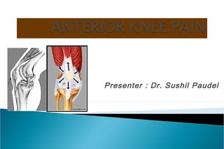 Quick Facts on Jumper's Knee - Kinetic Labs