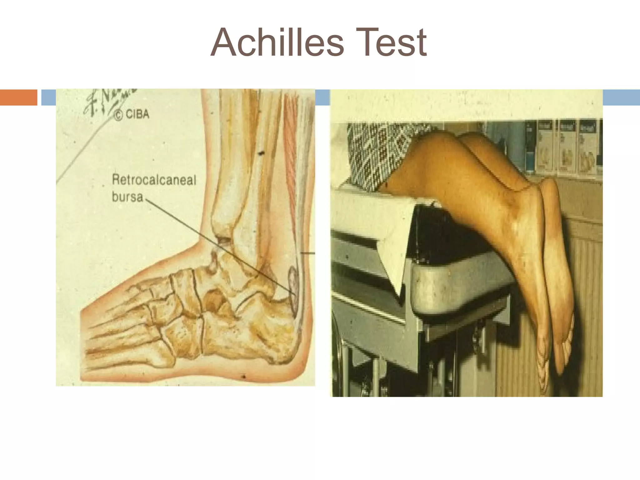 Anterior lateral and_posterior_compartments_of_calf | PPT