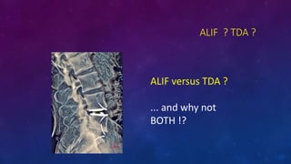 ALIF ? TDA ?
ALIF versus TDA ?
... and why not
BOTH !?
 