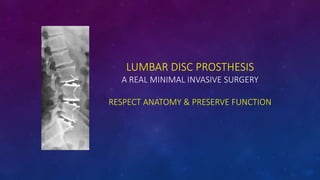 LUMBAR DISC PROSTHESIS
A REAL MINIMAL INVASIVE SURGERY
RESPECT ANATOMY & PRESERVE FUNCTION
 