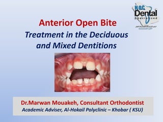 Anterior Open Bite
Treatment in the Deciduous
and Mixed Dentitions
Dr.Marwan Mouakeh, Consultant Orthodontist
Academic Adviser, Al-Hokail Polyclinic – Khobar ( KSU)
 