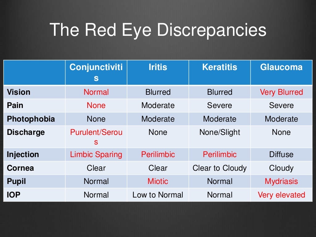 Anterior Pole Dr. Scott Burdette
