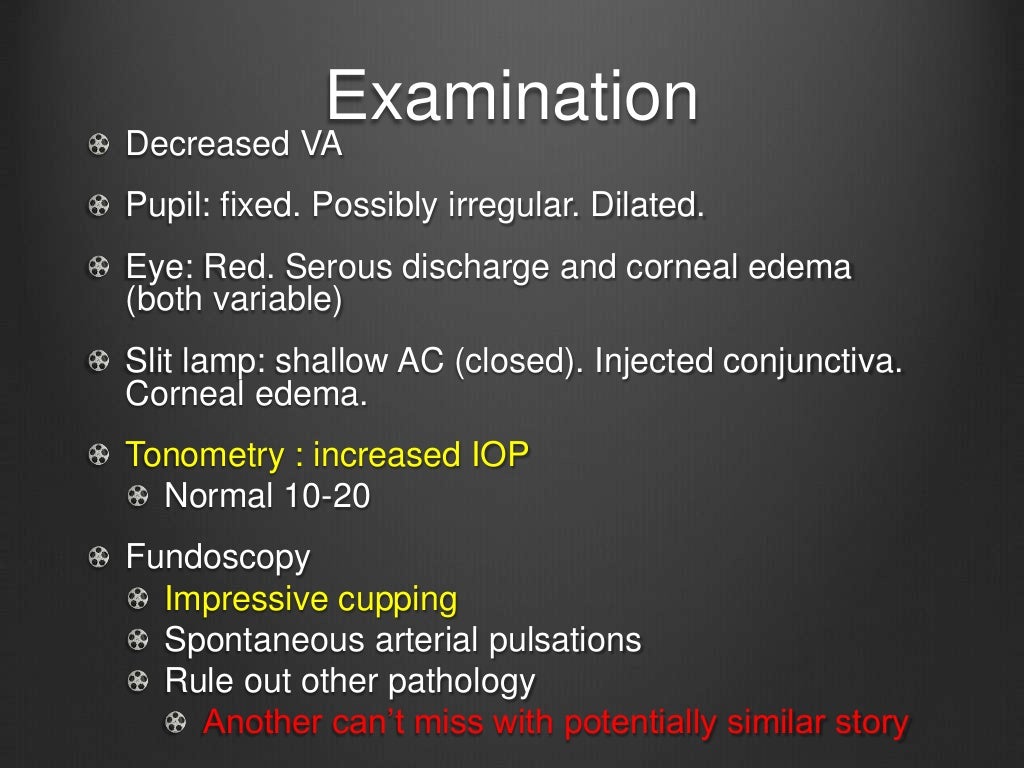 Anterior Pole Dr. Scott Burdette