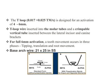ANTERIOR RETRACTION MECHANICs in orthodonticsS 1.pptx