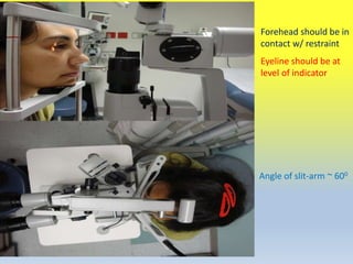 Slit Lamp Inspection Anterior segment examination | PPTX