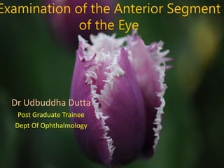Examination of the Anterior Segment
of the Eye
Dr Udbuddha Dutta
Post Graduate Trainee
Dept Of Ophthalmology
 