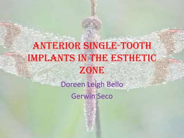Anterior Single Tooth implants in the Esthetic Zone | PPTX | Dental ...