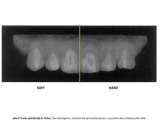 Anterior teeth selection | PPTX