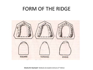 Deep Ridge Vs Shallow Ridge Tooth Anterior teeth selection | PPTX