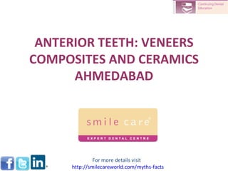 ANTERIOR TEETH: VENEERS COMPOSITES AND CERAMICS AHMEDABAD For more details visit  http:// smilecareworld.com /myths-facts 