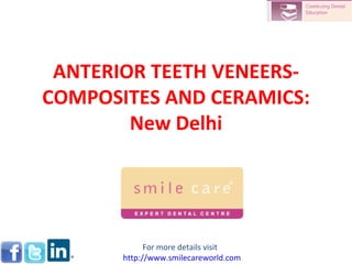 ANTERIOR TEETH VENEERS-
COMPOSITES AND CERAMICS:
        New Delhi




             For more details visit
       http://www.smilecareworld.com
 