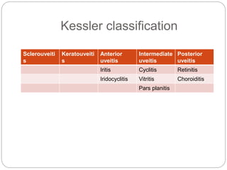Kessler classification
Sclerouveiti
s
Keratouveiti
s
Anterior
uveitis
Intermediate
uveitis
Posterior
uveitis
Iritis Cyclitis Retinitis
Iridocyclitis Vitritis Choroiditis
Pars planitis
 