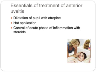 Essentials of treatment of anterior
uveitis
 Dilatation of pupil with atropine
 Hot application
 Control of acute phase of inflammation with
steroids
 