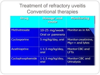 Treatment of refractory uveitis
Conventional therapies
 