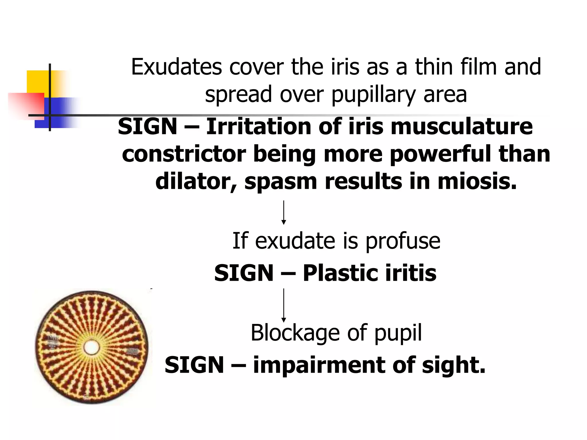 anterior uveitis.pptx