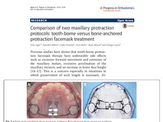 Xbite Tendency Anterior X bite.pptx in orthodontics//// | PPTX