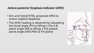 Antero-posterior cephalometric analysis. | PPTX