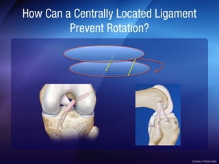 Anterolateral Ligament (ALL) | PDF