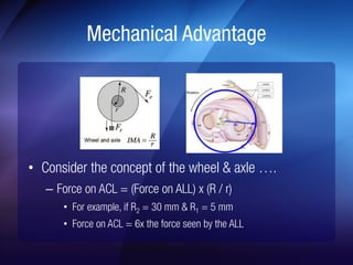 Mechanical Advantage 
• 
– Force on ACL = (Force on ALL) x (R / r) 
• For example, if R2 = 30 mm & R1 = 5 mm 
• Force on A...