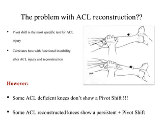 The Antero-lateral ligament 