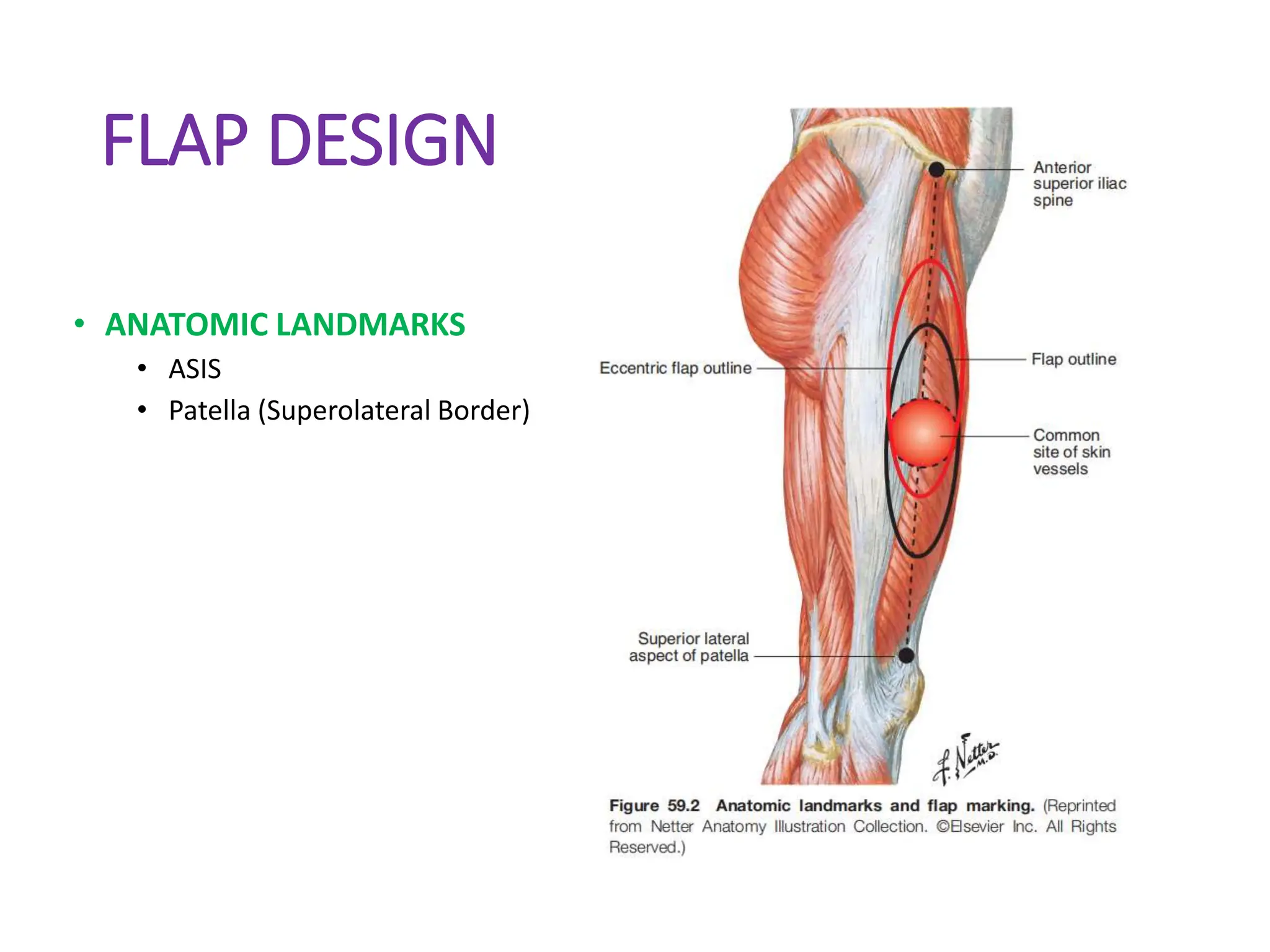 Anterolateral thigh flap.pptx