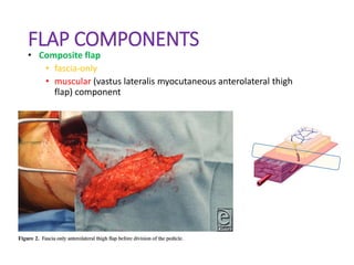 Anterolateral thigh flap.pptx
