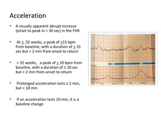 Anterpartum fetal surveillance | PPT