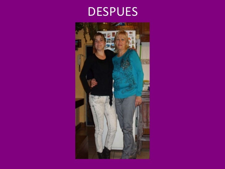 Bajar de peso 30 kilos en 6 meses de edad