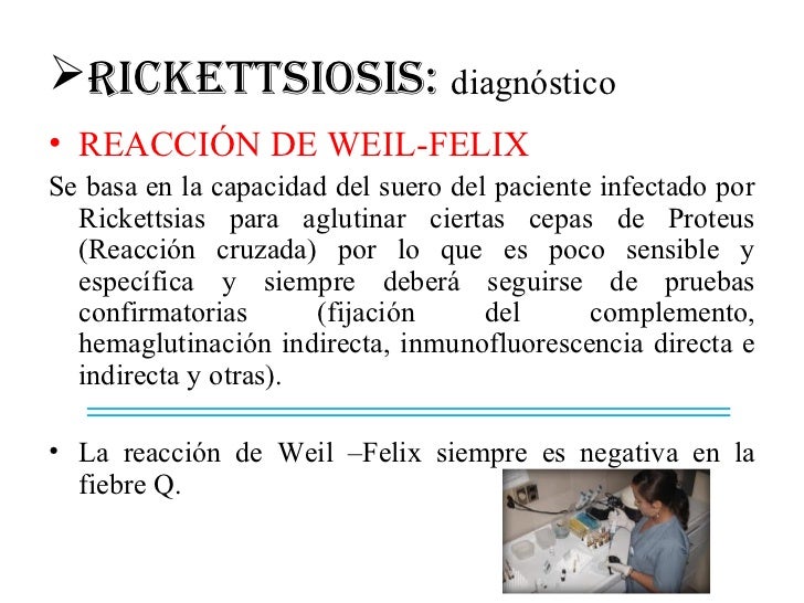 Proteus Ox 19 Positivo Que Es abstractor Proteus Ox 19 Positivo Que Es abstractor
