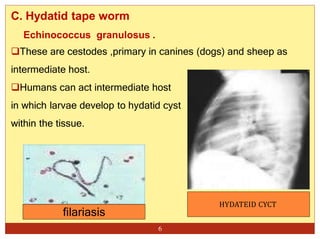 C. Hydatid tape worm
Echinococcus granulosus .
These are cestodes ,primary in canines (dogs) and sheep as
intermediate host.
Humans can act intermediate host
in which larvae develop to hydatid cyst
within the tissue.
HYDATEID CYCT
6
filariasis
 