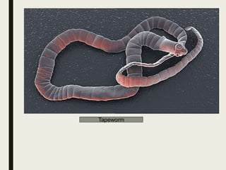 Tapeworm
 